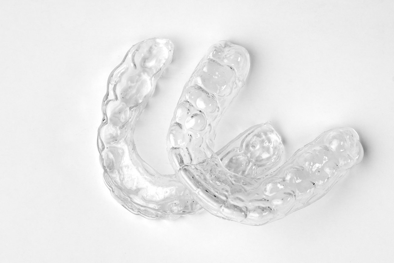 Apparecchio ortodontico fisso - Studio Dentistico Luigi Galasso